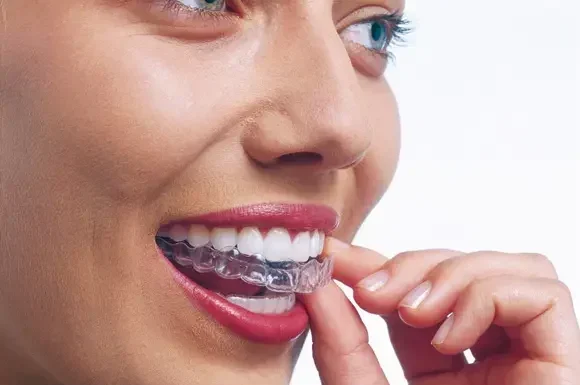 Invisalign, Invisalign Doctor, Dr Neda Gorji, Clear Aligner, Park St Dental Practice, Sydney Northern Beaches, Mona Vale, Cosmetic Dentistry